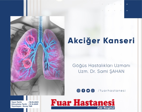 AKCİĞER KANSERİ