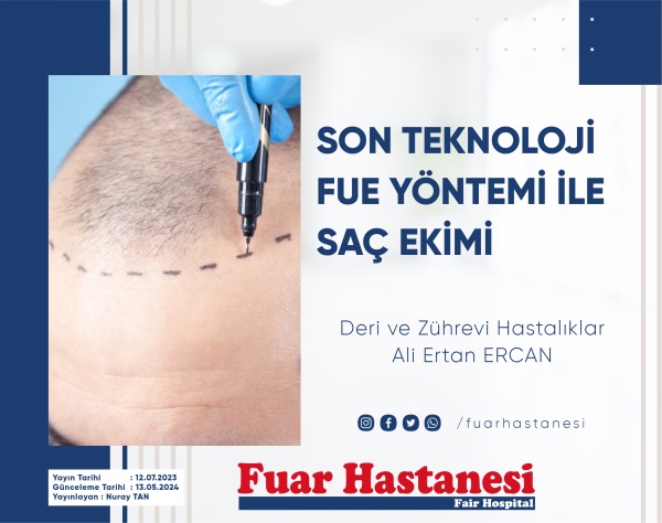 SON TEKNOLOJİ FUE YÖNTEMİ İLE SAÇ EKİMİ ÖZEL FUAR HASTANESİ’NDE