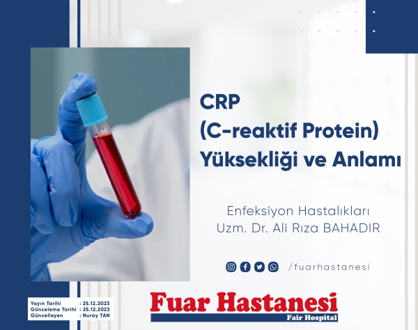 CRP (C-reaktif Protein) Yüksekliği ve Anlamı