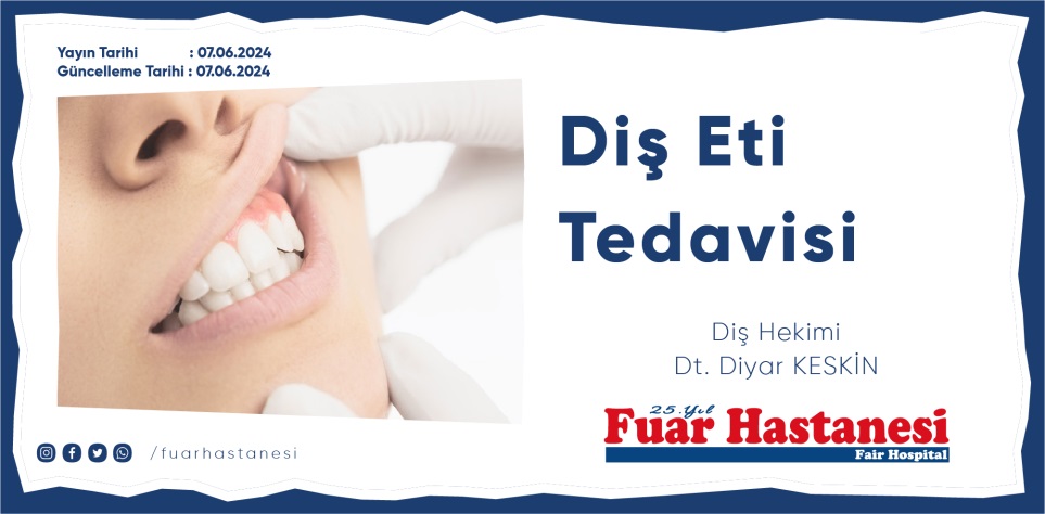DİŞ ETİ TEDAVİSİ