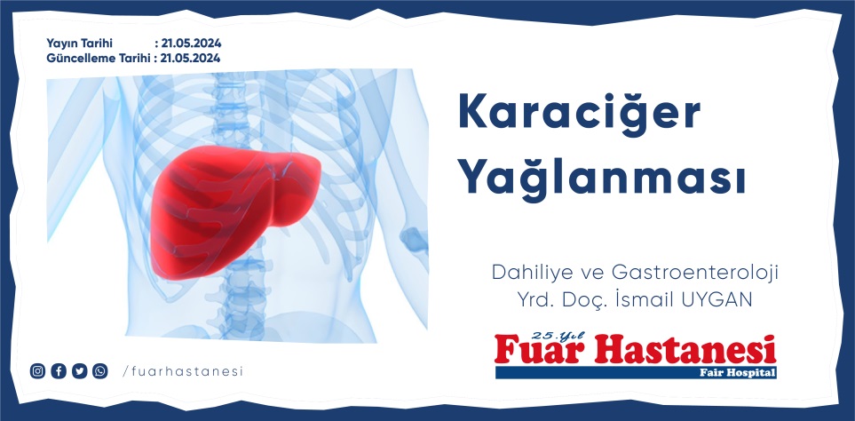 Karaciğer Yağlanması Türkiye’de Her 10 Kişiden 3’ünü Etkileyen Sessiz Tehlike