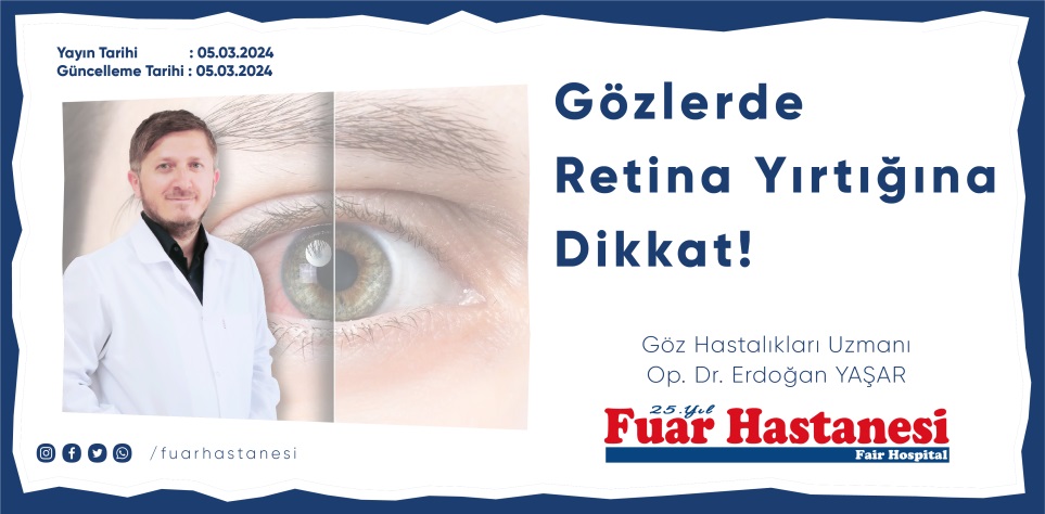 Gözlerde Retina Yırtığına Dikkat