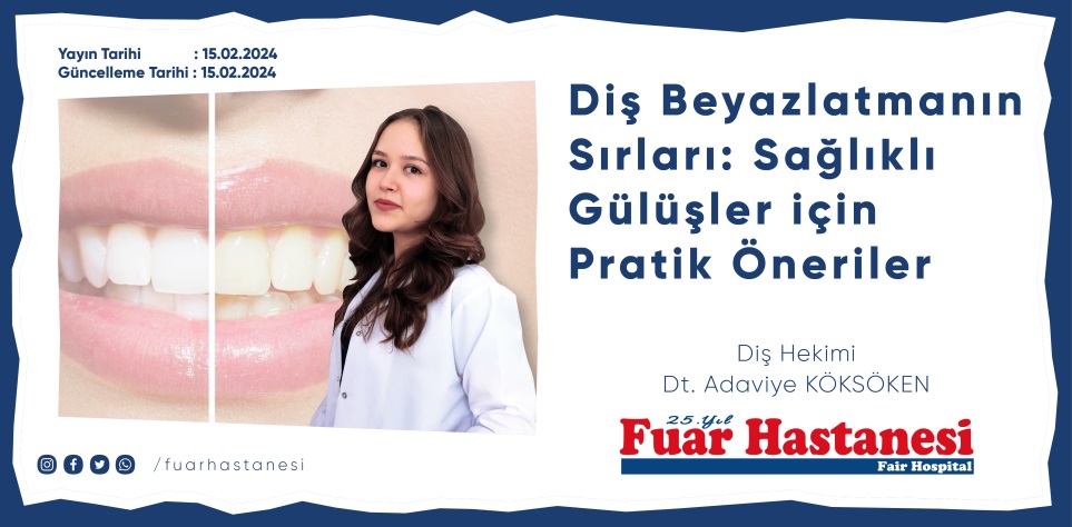 Diş Beyazlatmanın Sırları Sağlıklı Gülüşler için Pratik Öneriler