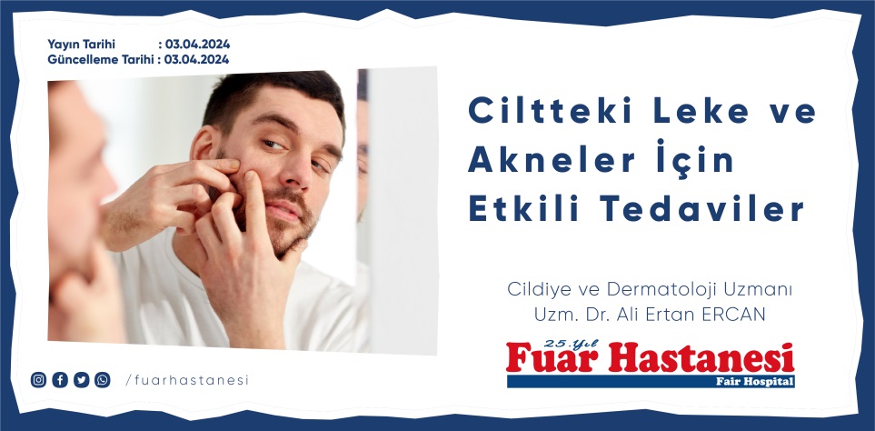 Ciltteki Leke ve Akneler İçin Etkili Tedaviler