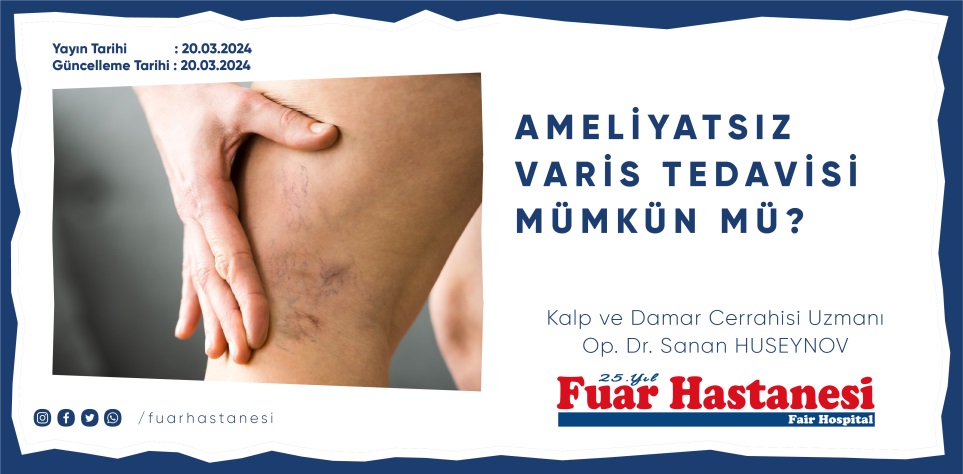 AMELİYATSIZ VARİS TEDAVİSİ MÜMKÜN MÜ?