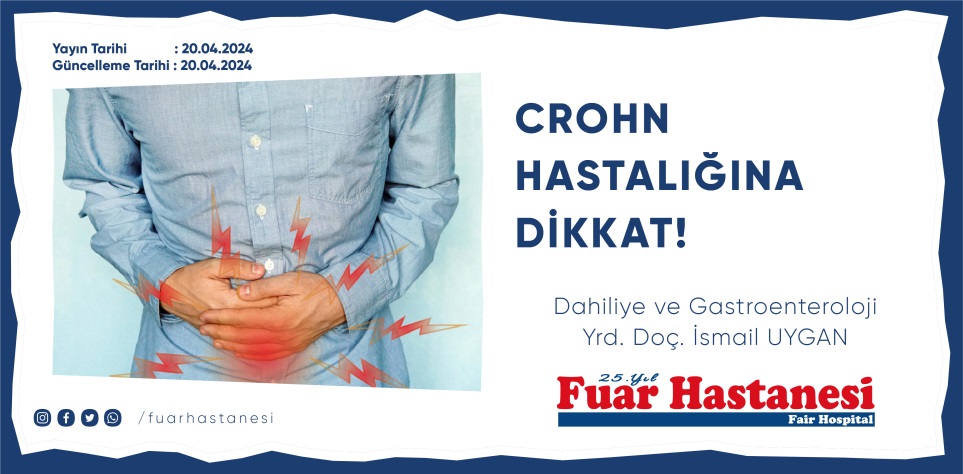 CROHN HASTALIĞINA DİKKAT