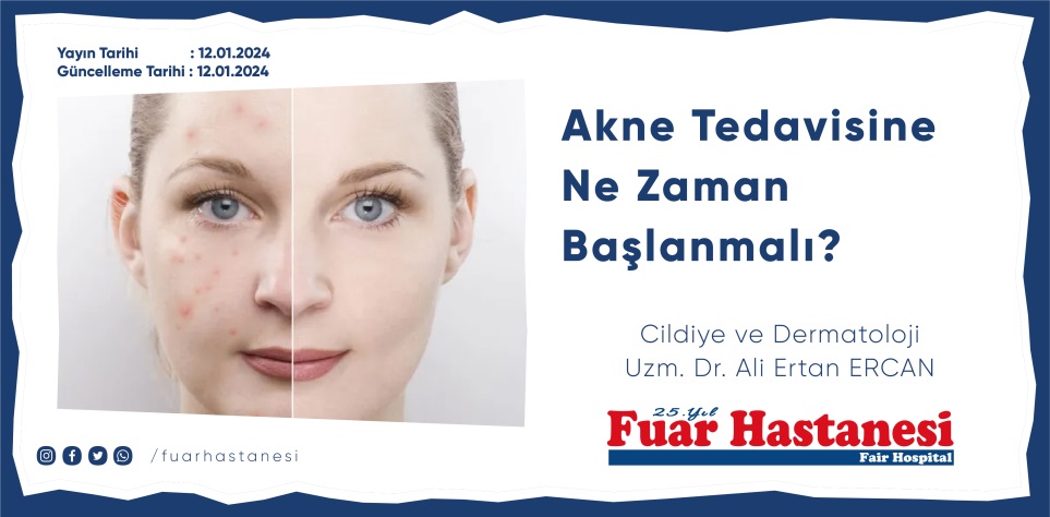 Akne Tedavisine Ne Zaman Başlanmalı? Dr. Ali Ertan Ercan'dan Öneriler