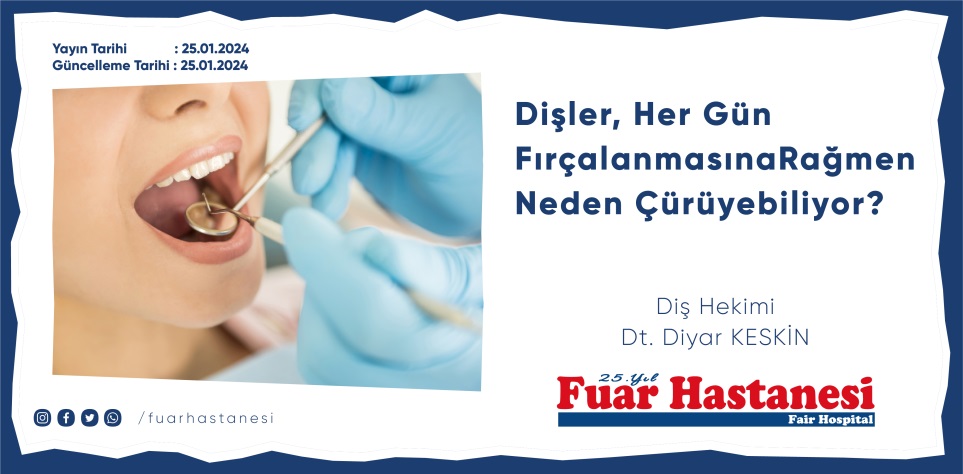 Dişler, Her Gün Fırçalanmasına Rağmen Neden Çürüyebiliyor?